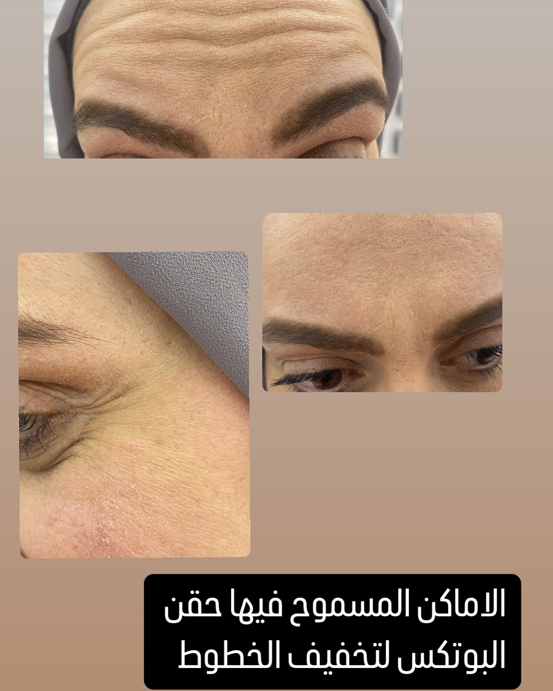 Video Images